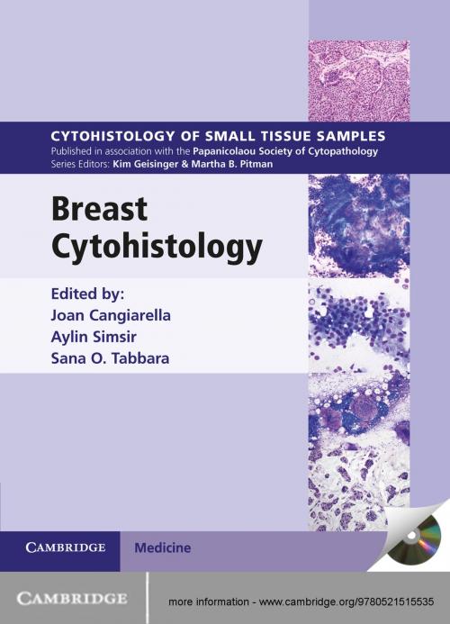 Cover of the book Breast Cytohistology by , Cambridge University Press