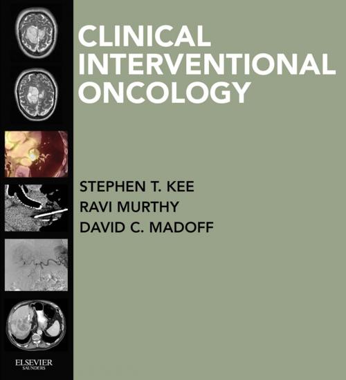 Cover of the book Clinical Interventional Oncology E-Book by Stephen T Kee, MD, David C Madoff, MD, Ravi Murthy, MD, FACP, Elsevier Health Sciences