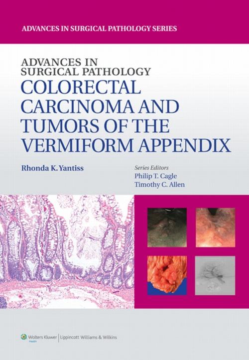 Cover of the book Advances in Surgical Pathology: Colorectal Carcinoma and Tumors of the Vermiform Appendix by Rhonda Yantiss, Wolters Kluwer Health