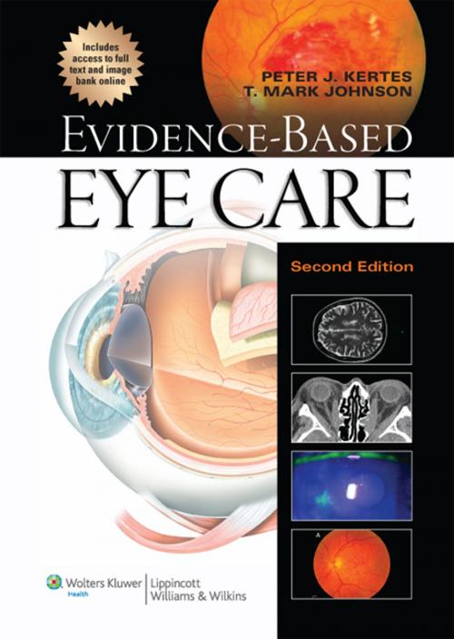 Cover of the book Evidence-Based Eye Care by Peter J. Kertes, T. Mark Johnson, Wolters Kluwer Health