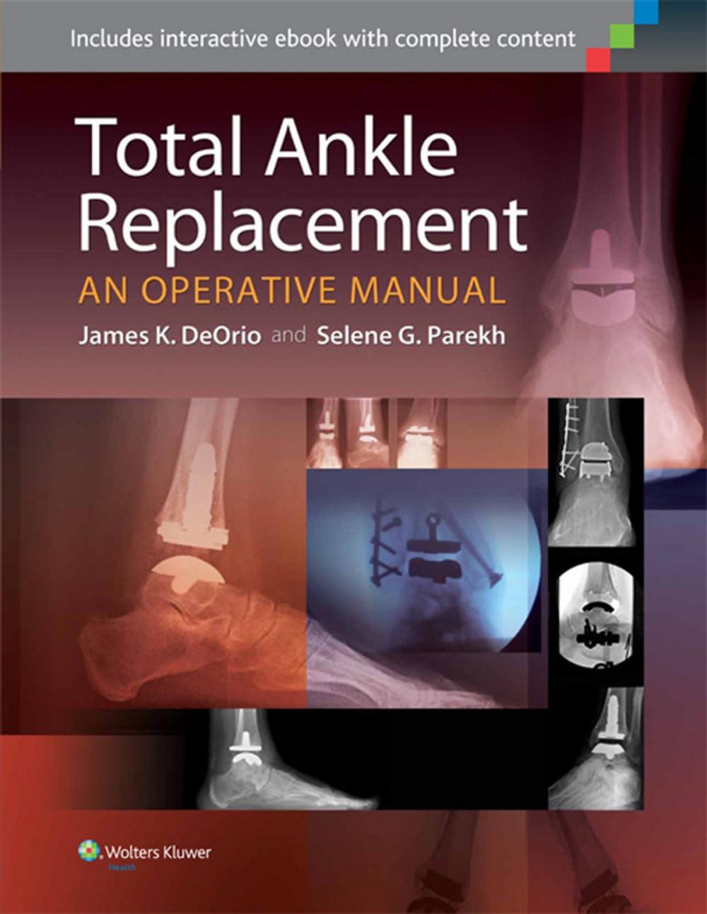 Big bigCover of Total Ankle Replacement: An Operative Manual
