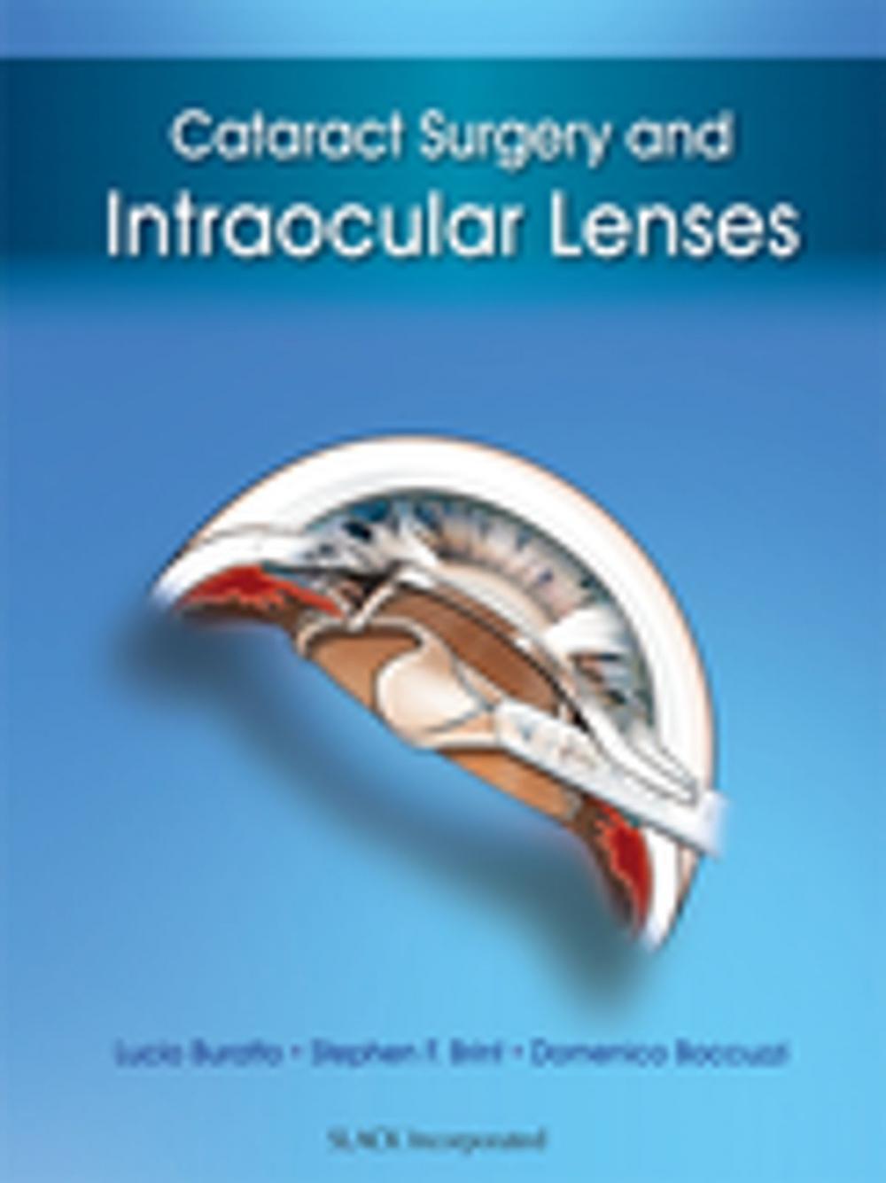 Big bigCover of Cataract Surgery and Intraocular Lenses