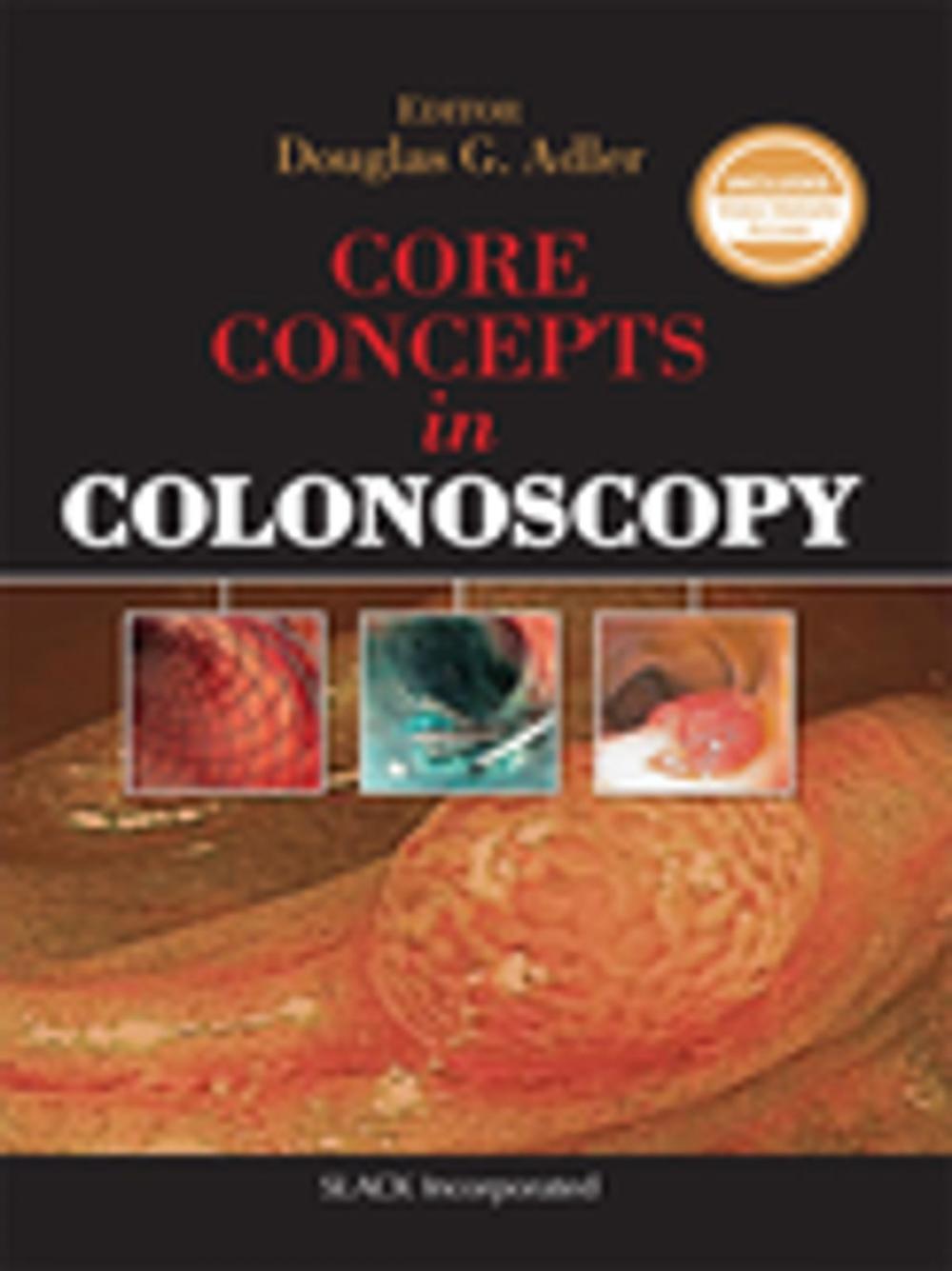 Big bigCover of Core Concepts in Colonoscopy