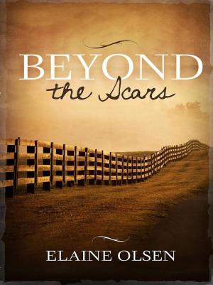 Book cover of Beyond the Scars