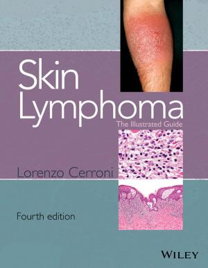 Cover of the book Skin Lymphoma by Daniel T. Larose, Chantal D. Larose