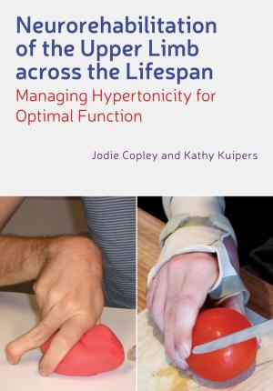 Cover of the book Neurorehabilitation of the Upper Limb Across the Lifespan by Matthew Leitch