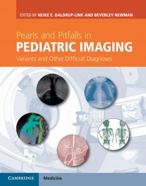Cover of the book Pearls and Pitfalls in Pediatric Imaging by Alain Vuylsteke, Daniel Brodie, Alain Combes, Jo-anne Fowles, Giles Peek