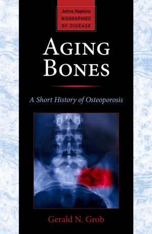 Book cover of Aging Bones