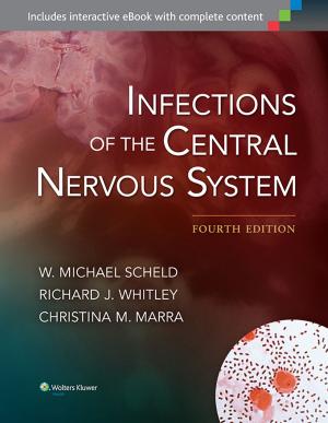 Cover of the book Infections of the Central Nervous System by Richard S. Irwin, Craig Lilly, James M. Rippe