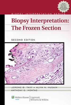 Cover of the book Biopsy Interpretation: The Frozen Section by Peter J. Zimetbaum, Mark E. Josephson