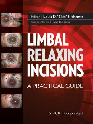 Cover of the book Limbal Relaxing Incisions by Narayana Nethralaya