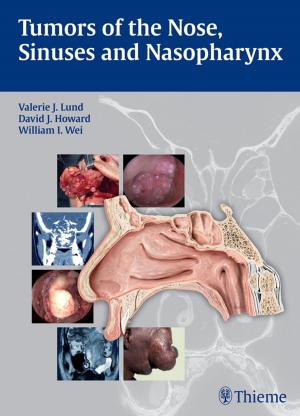 Cover of the book Tumors of the Nose, Sinuses and Nasopharynx by Jaime Tisnado, Philip C. Pieters, Matthew A. Mauro