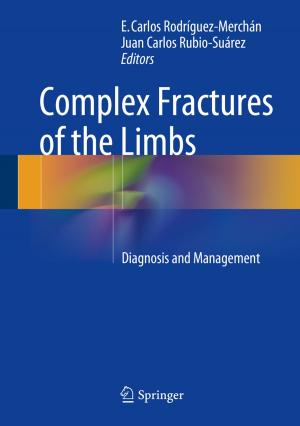 Cover of the book Complex Fractures of the Limbs by Siegfried Bosch