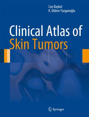 Cover of the book Clinical Atlas of Skin Tumors by Andrei B. Koudriavtsev, Reginald F. Jameson, Wolfgang Linert