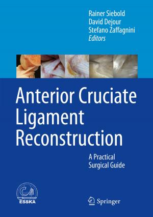 Cover of the book Anterior Cruciate Ligament Reconstruction by G. Abel, R. Bos, I.H. Bowen, R.F. Chandler, D. Corrigan, I.J. Cubbin, P.A.G.M: De Smet, N. Pras, J-.J.C. Scheffer, T.A. Van Beek, W. Van Uden, H.J. Woerdenbag