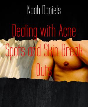 Book cover of Dealing with Acne Spots and Skin Break Outs