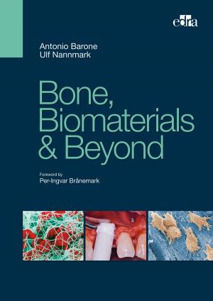 Cover of the book Bone, Biomaterials & Beyond by Francesco Bottaccioli