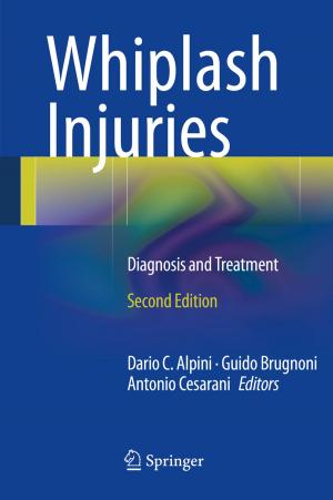 Cover of the book Whiplash Injuries by L. Allegra, F. Blasi