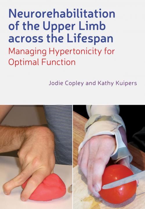 Cover of the book Neurorehabilitation of the Upper Limb Across the Lifespan by Jodie Copley, Kathy Kuipers, Wiley