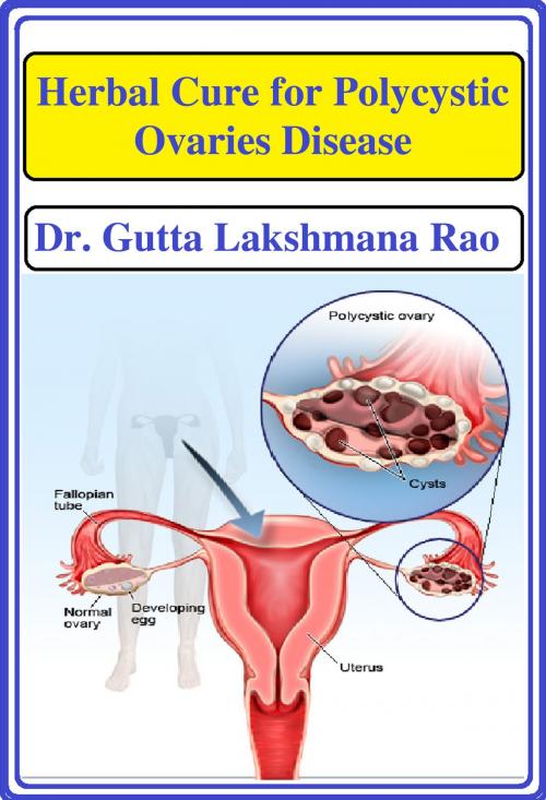 Cover of the book Herbal Cure for Poylcystic Ovaries Disease by Dr Gutta Lakshmana Rao, Dr Gutta Lakshmana Rao