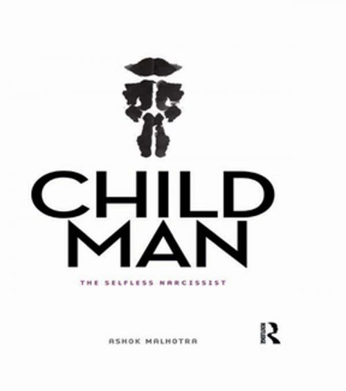 Cover of the book Child Man by Ashok Malhotra, Taylor and Francis