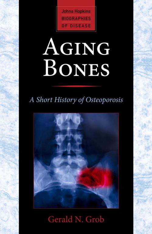 Cover of the book Aging Bones by Gerald N. Grob, Johns Hopkins University Press