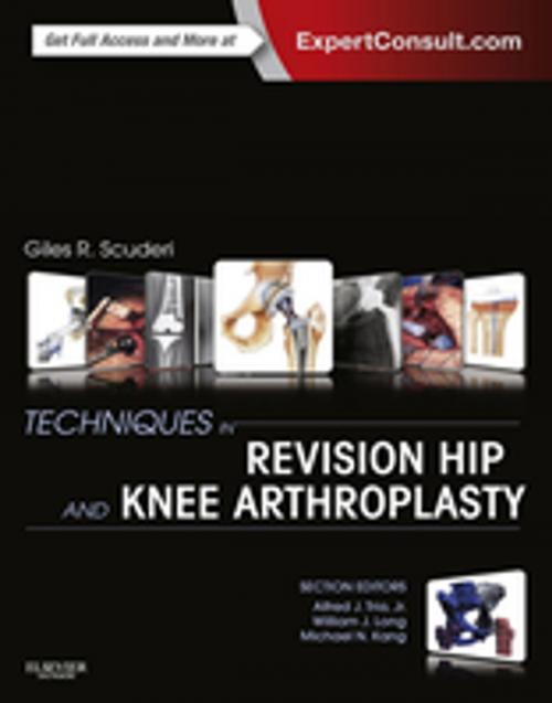 Cover of the book Techniques in Revision Hip and Knee Arthroplasty E-Book by Giles R Scuderi, MD, Elsevier Health Sciences