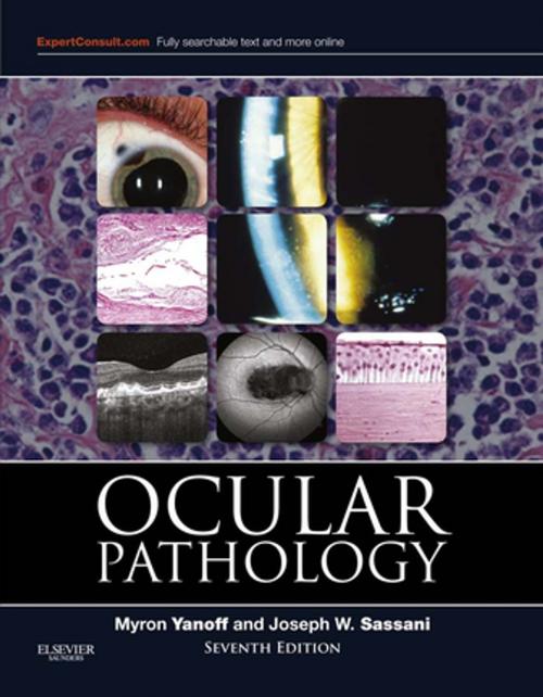 Cover of the book Ocular Pathology E-Book by Myron Yanoff, MD, Joseph W. Sassani, MD, MHA, Elsevier Health Sciences