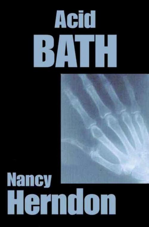 Cover of the book Acid Bath by Nancy Herndon, Open Road Media