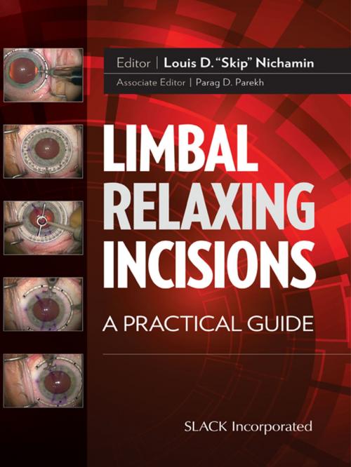 Cover of the book Limbal Relaxing Incisions by , SLACK Incorporated