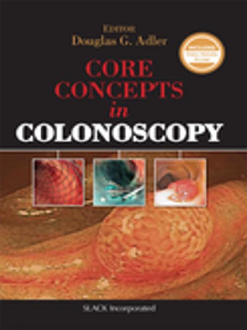 Cover of the book Core Concepts in Colonoscopy by , SLACK Incorporated
