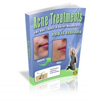 bigCover of the book Acne Treatments by 