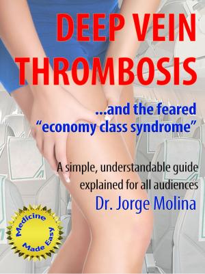 Book cover of Deep Vein Thrombosis