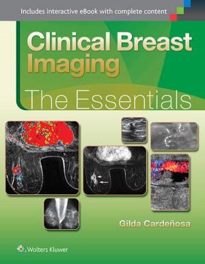 Cover of the book Clinical Breast Imaging: The Essentials by Alexander Drilon, Michael Postow, Neil Vasan, Maria I. Carlo