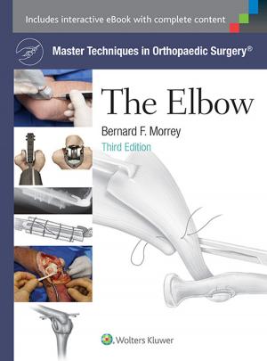 Cover of the book Master Techniques in Orthopaedic Surgery: The Elbow by William H. Rosenblatt, Wanda M. Popescu