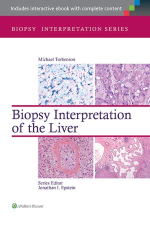 Cover of the book Biopsy Interpretation of the Liver by Bódy László, Botos Katalin, Katona Klára, Zavodnyik József Szerkesztette: Katona Klára