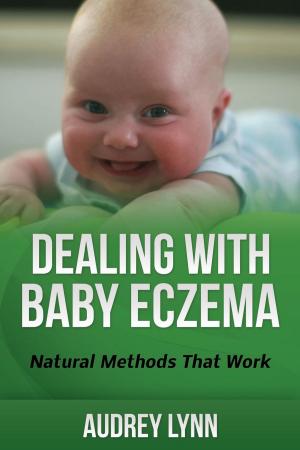 Cover of the book Dealing With Baby Eczema by Michael Anderson
