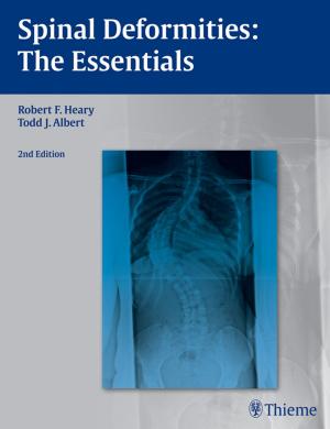 Cover of the book Spinal Deformities by Uwe Fischer, Friedemann Baum