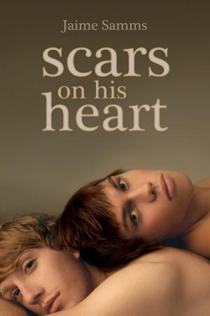 Cover of the book Scars on His Heart by K.C. Wells