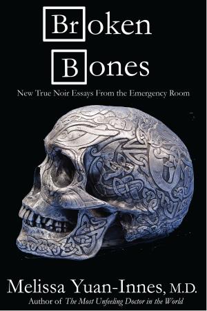 Cover of the book Broken Bones by Jon Huddy