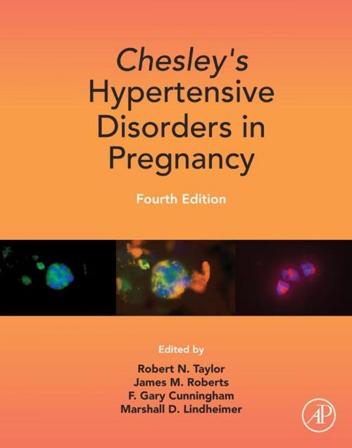 Cover of the book Chesley's Hypertensive Disorders in Pregnancy by , Elsevier Science