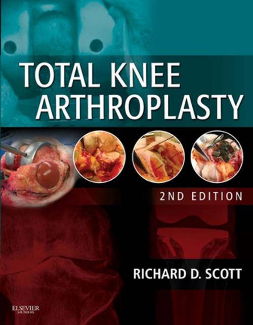Cover of the book Total Knee Arthroplasty E-Book by Richard D. Scott, MD, Elsevier Health Sciences
