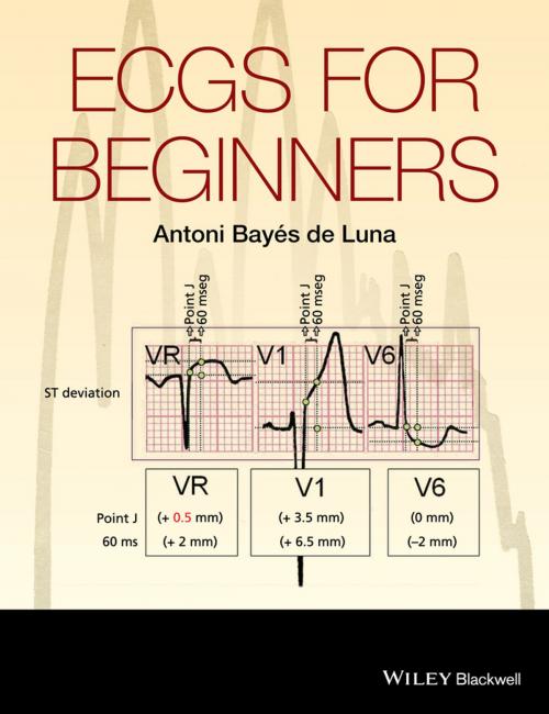 Cover of the book ECGs for Beginners by Antoni Bayés de Luna, Wiley