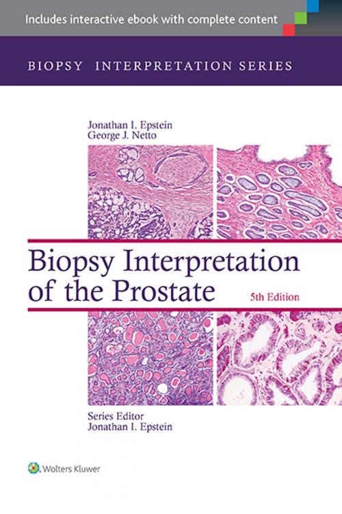 Cover of the book Biopsy Interpretation of the Prostate by Jonathan I. Epstein, George J. Netto, Wolters Kluwer Health