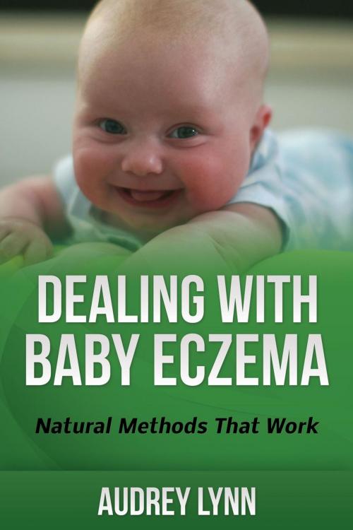 Cover of the book Dealing With Baby Eczema by Audrey Lynn, Audrey Lynn