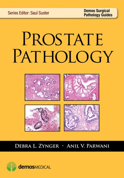 Cover of the book Prostate Pathology by Anil Parwani, MD, Saul Suster, MD, Debra Zynger, MD, Springer Publishing Company
