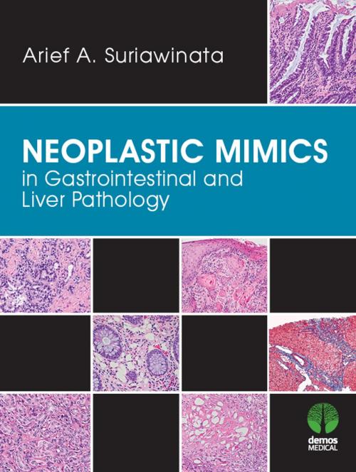 Cover of the book Neoplastic Mimics in Gastrointestinal and Liver Pathology by Arief Suriawinata, MD, Springer Publishing Company
