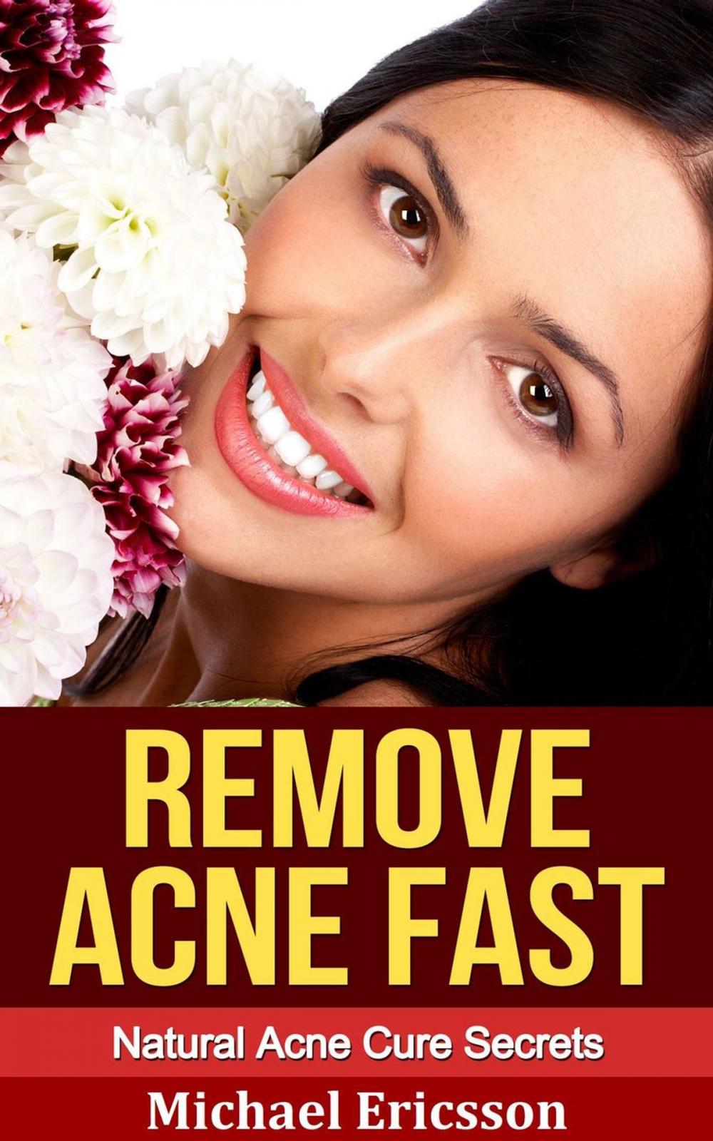 Big bigCover of Remove Acne Fast: Natural Acne Cure Secrets