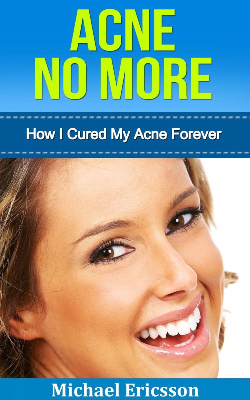 Big bigCover of Acne No More: How I Cured My Acne Forever