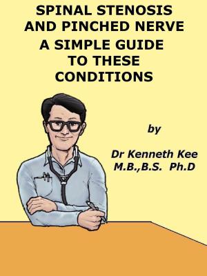 Book cover of Spinal Stenosis And Pinched Nerve A Simple Guide to These conditions